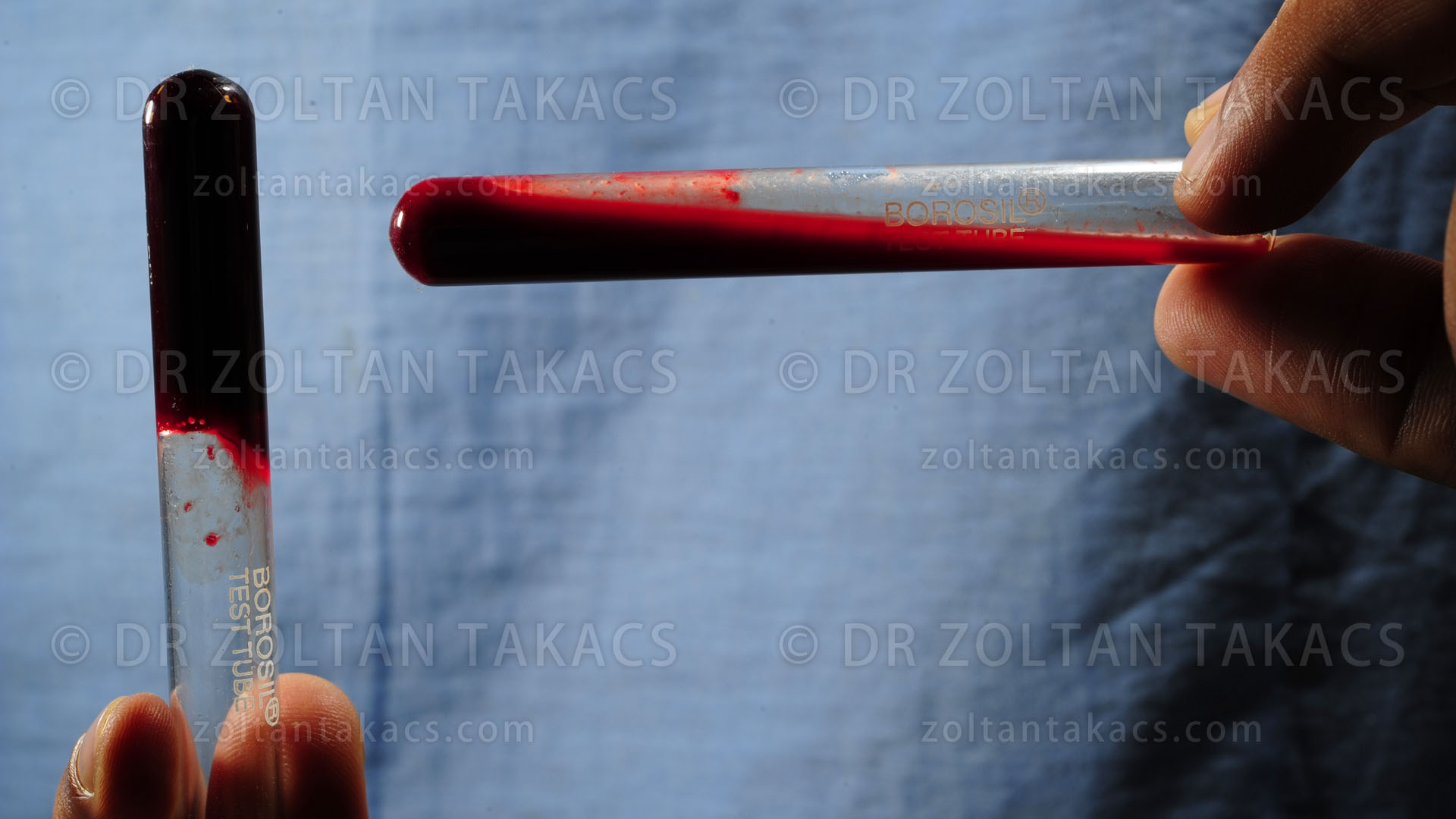 Snakebite effect on blood